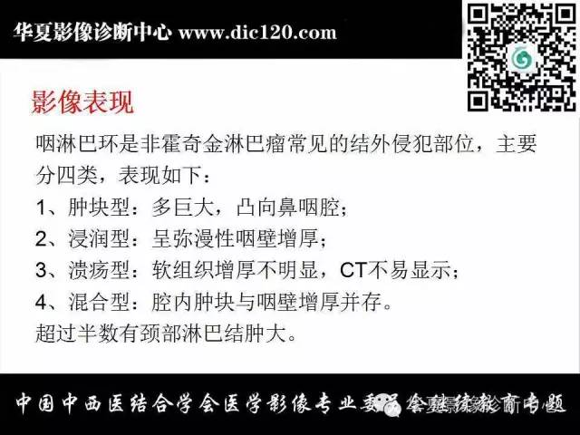 【PPT】颈部常见病变影像诊断