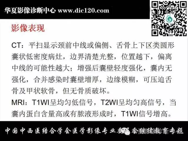 【PPT】颈部常见病变影像诊断