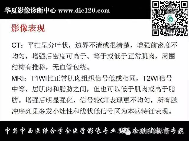 【PPT】颈部常见病变影像诊断