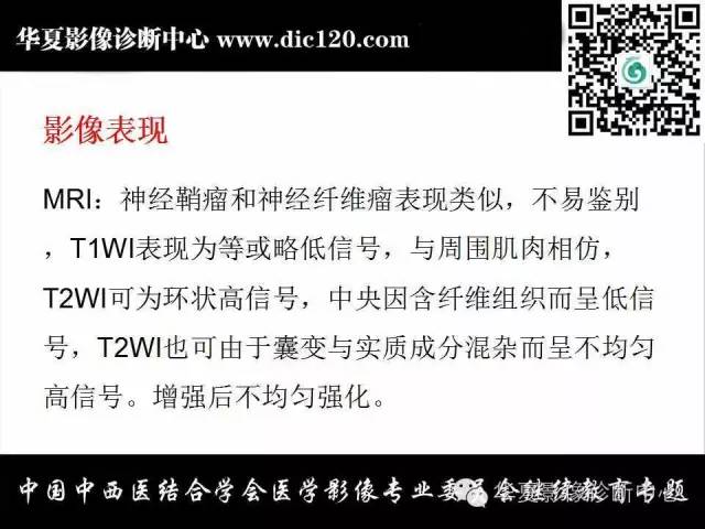 【PPT】颈部常见病变影像诊断