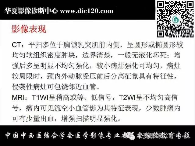 【PPT】颈部常见病变影像诊断