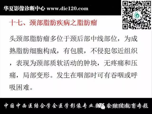 【PPT】颈部常见病变影像诊断