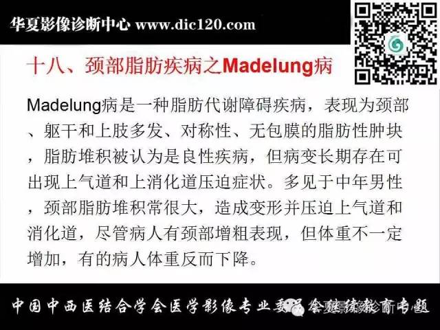 【PPT】颈部常见病变影像诊断