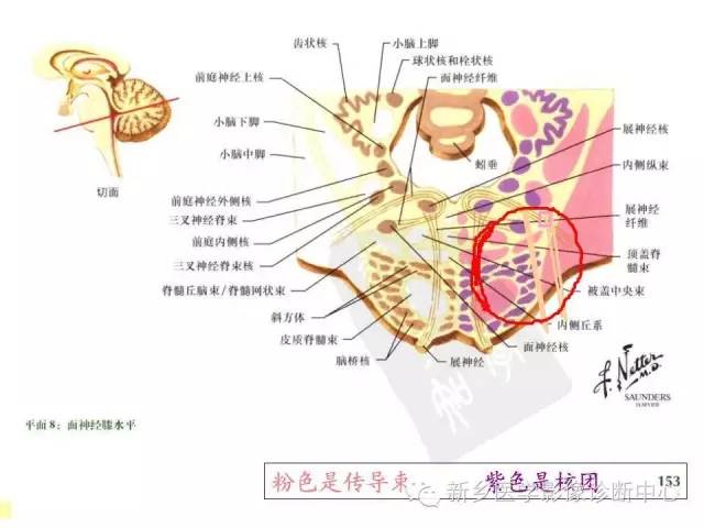 【PPT】影像综合征——脑桥的三大综合征
