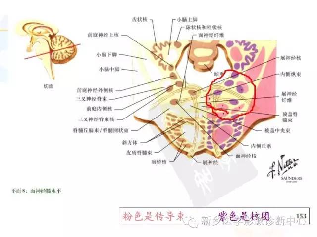【PPT】影像综合征——脑桥的三大综合征