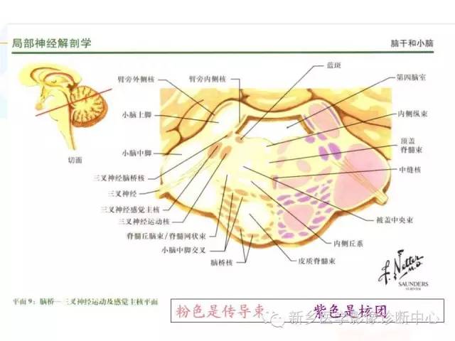 【PPT】影像综合征——脑桥的三大综合征