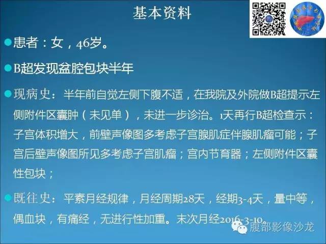 卵巢单纯性囊肿