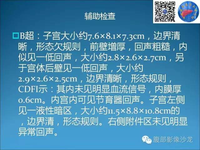 卵巢单纯性囊肿