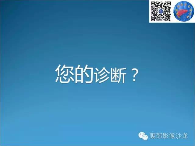 卵巢单纯性囊肿