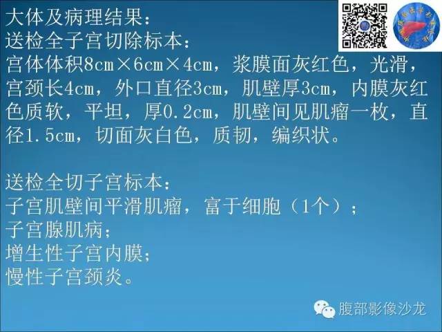 卵巢单纯性囊肿