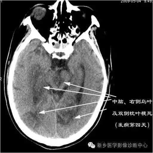 自动草稿