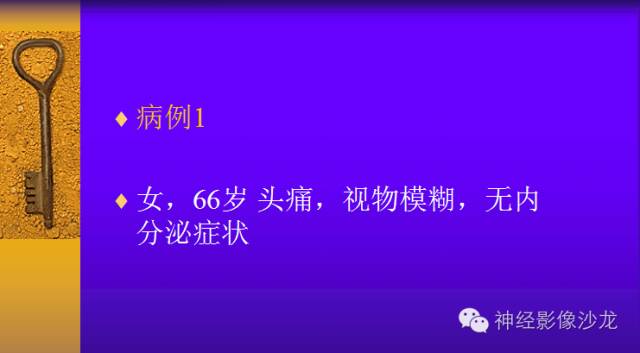 【病例】颅内鞍区病变七例鉴别诊断分析