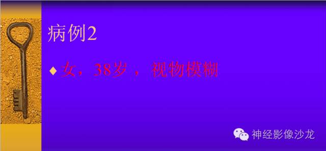 【病例】颅内鞍区病变七例鉴别诊断分析 【病例】颅内鞍区病变七例鉴别诊断分析