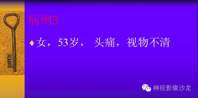 【病例】颅内鞍区病变七例鉴别诊断分析 【病例】颅内鞍区病变七例鉴别诊断分析