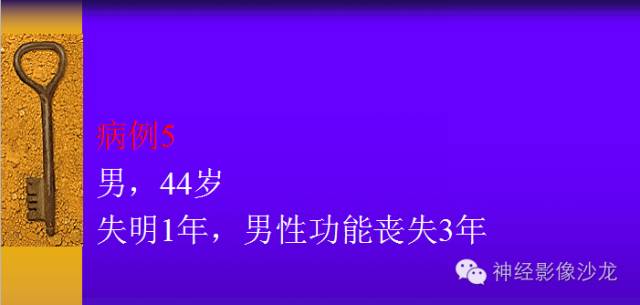 【病例】颅内鞍区病变七例鉴别诊断分析 【病例】颅内鞍区病变七例鉴别诊断分析