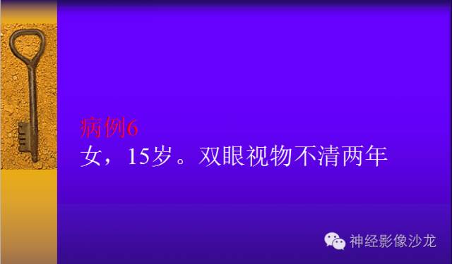 【病例】颅内鞍区病变七例鉴别诊断分析 【病例】颅内鞍区病变七例鉴别诊断分析
