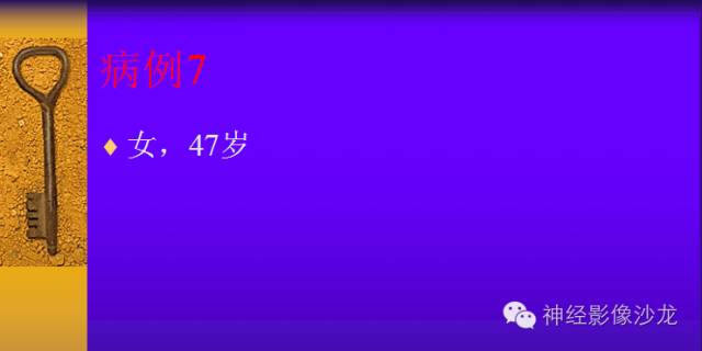 【病例】颅内鞍区病变七例鉴别诊断分析 【病例】颅内鞍区病变七例鉴别诊断分析