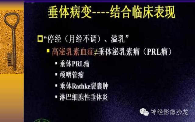 【病例】颅内鞍区病变七例鉴别诊断分析 【病例】颅内鞍区病变七例鉴别诊断分析