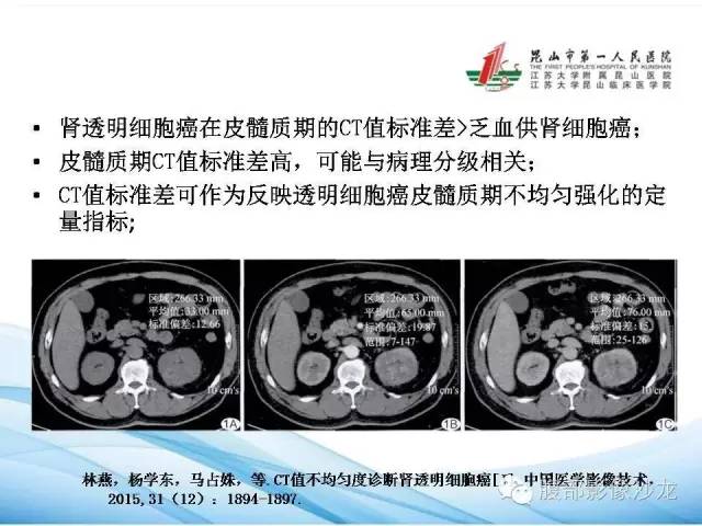 【PPT】透明细胞肾癌的诊断与鉴别