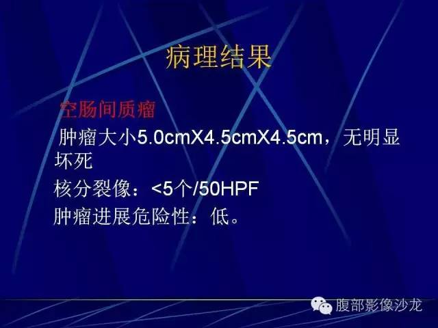 【病例】胃肠道间质瘤1例CT影像表现 【病例】胃肠道间质瘤1例CT影像表现