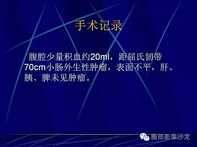 【病例】胃肠道间质瘤1例CT影像表现 【病例】胃肠道间质瘤1例CT影像表现