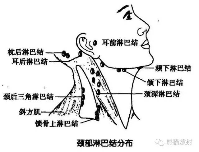 【病例】颌下区表皮样囊肿1例MR影像表现 【病例】颌下区表皮样囊肿1例MR影像表现