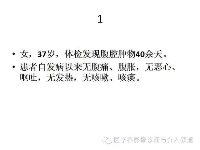 【病例】腹膜后神经鞘瘤2例MR影像表现