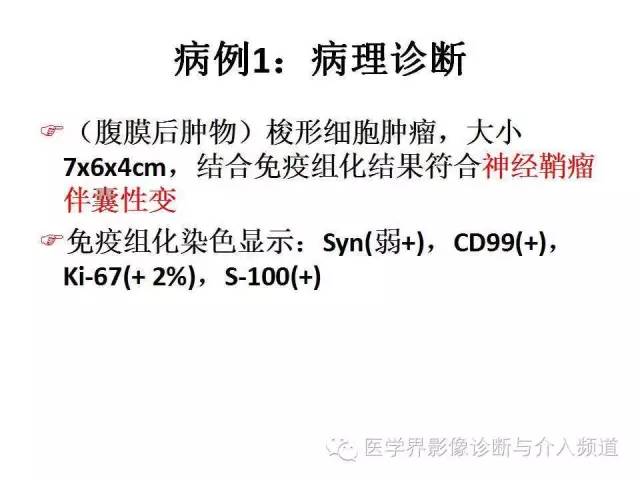 【病例】腹膜后神经鞘瘤2例MR影像表现