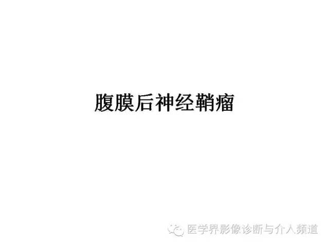 【病例】腹膜后神经鞘瘤2例MR影像表现