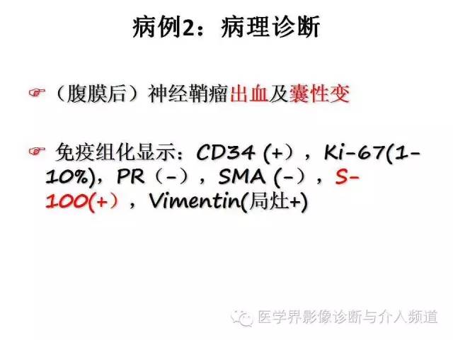 【病例】腹膜后神经鞘瘤2例MR影像表现