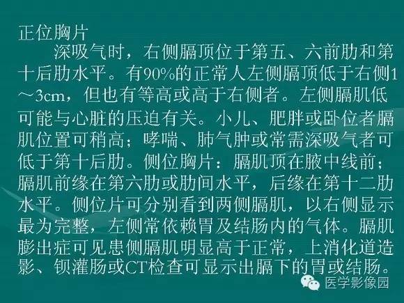 【PPT】膈肌膨出症影像学表现
