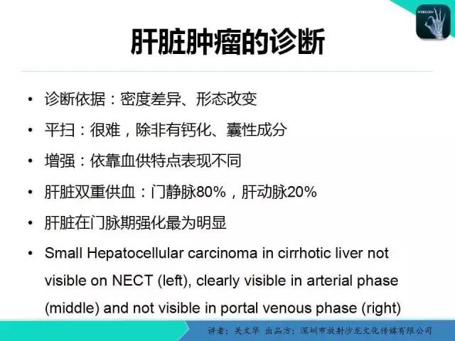 【PPT】精简版肝脏疾病的CT诊断