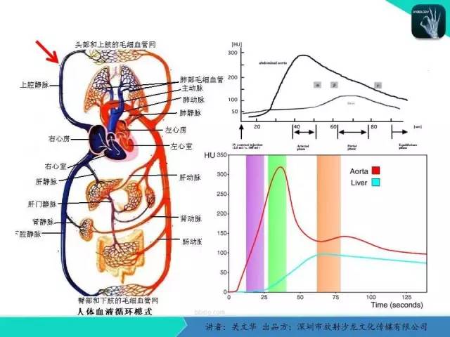【PPT】精简版肝脏疾病的CT诊断