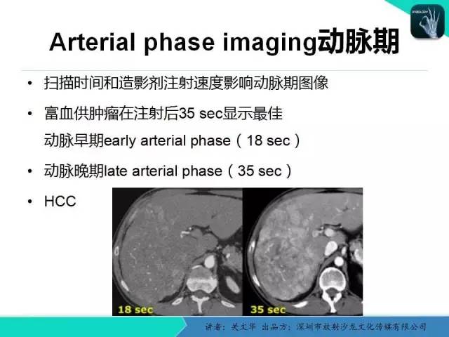 【PPT】精简版肝脏疾病的CT诊断