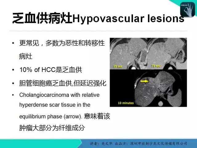 【PPT】精简版肝脏疾病的CT诊断