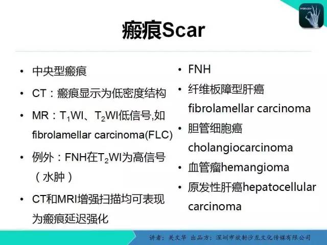 【PPT】精简版肝脏疾病的CT诊断