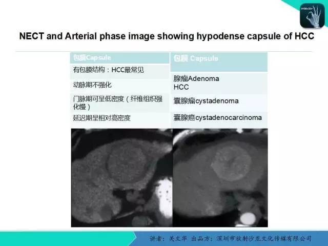 【PPT】精简版肝脏疾病的CT诊断