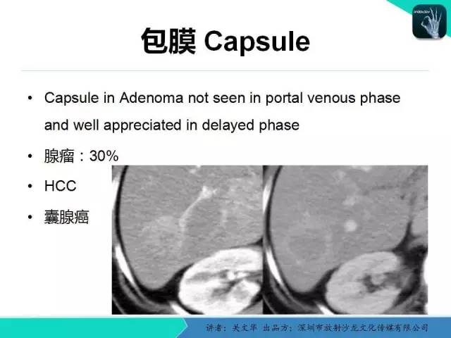 【PPT】精简版肝脏疾病的CT诊断