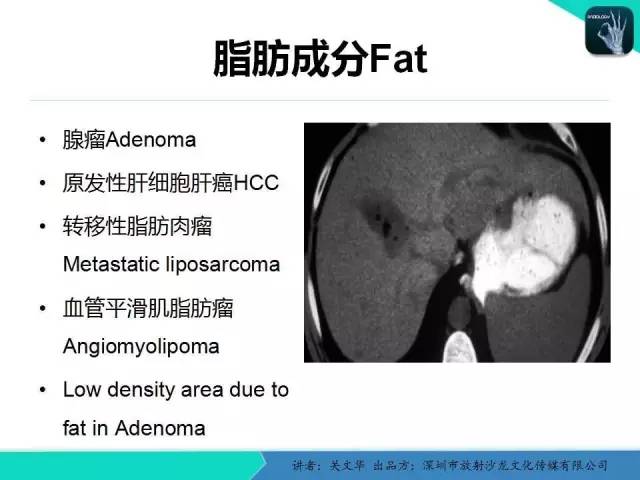 【PPT】精简版肝脏疾病的CT诊断