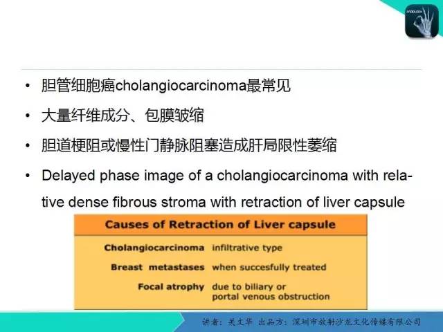 【PPT】精简版肝脏疾病的CT诊断