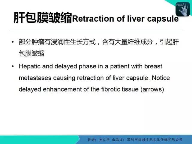 【PPT】精简版肝脏疾病的CT诊断