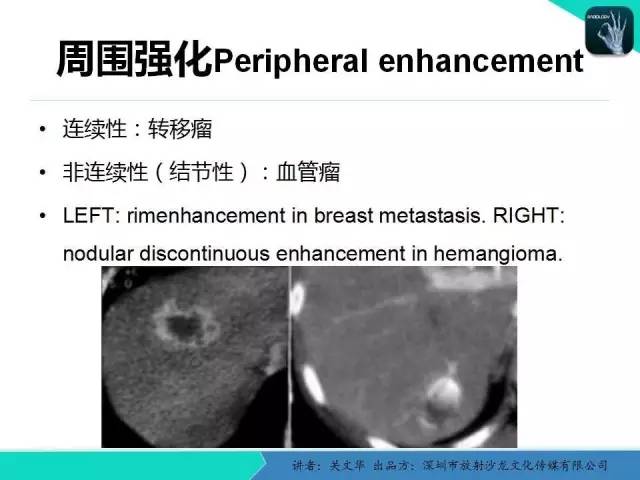 【PPT】精简版肝脏疾病的CT诊断