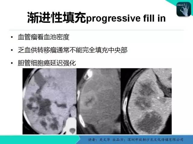 【PPT】精简版肝脏疾病的CT诊断