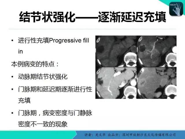 【PPT】精简版肝脏疾病的CT诊断