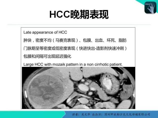 【PPT】精简版肝脏疾病的CT诊断