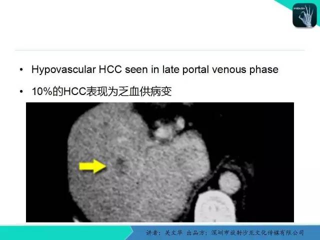 【PPT】精简版肝脏疾病的CT诊断