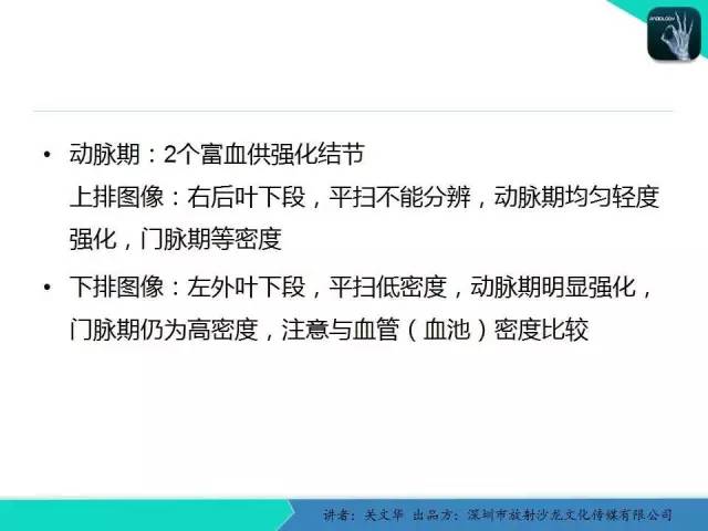 【PPT】精简版肝脏疾病的CT诊断