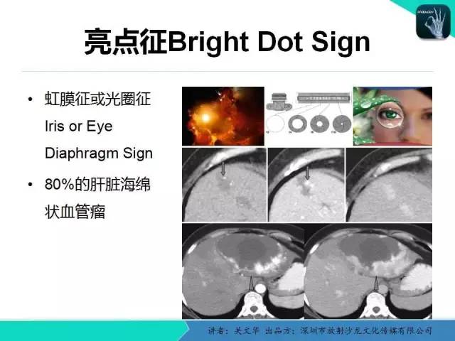 【PPT】精简版肝脏疾病的CT诊断