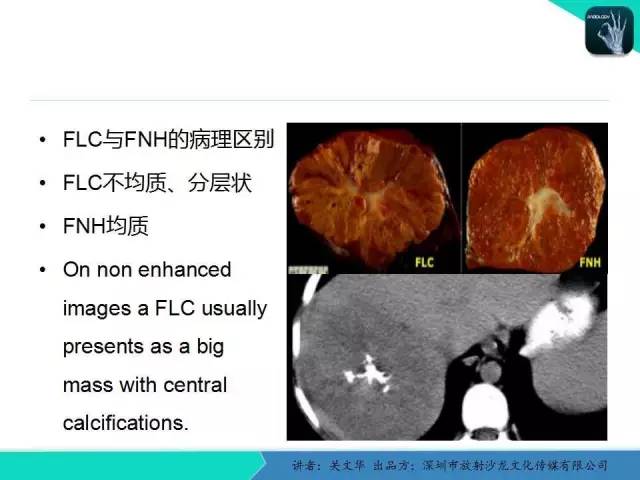 【PPT】精简版肝脏疾病的CT诊断