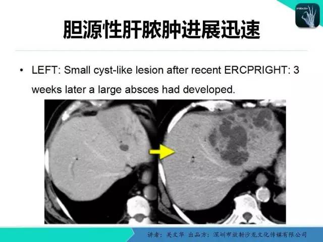 【PPT】精简版肝脏疾病的CT诊断